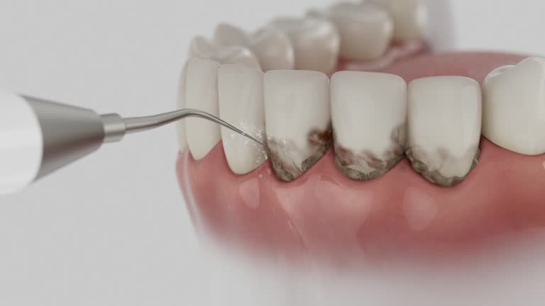 Trusted Invisalign Clear Aligners service in Farmington, MS - Dentist Open Now